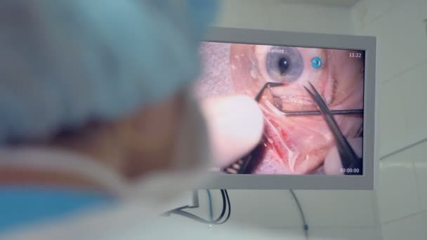 Beeld van menselijk oog tijdens chirurgie — Stockvideo