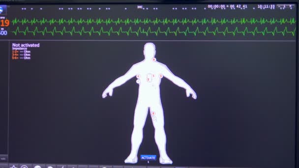 Paramètres vitaux, ecg, cardiogramme sur un écran médical. Le moniteur patient affiche des signes vitaux . — Video