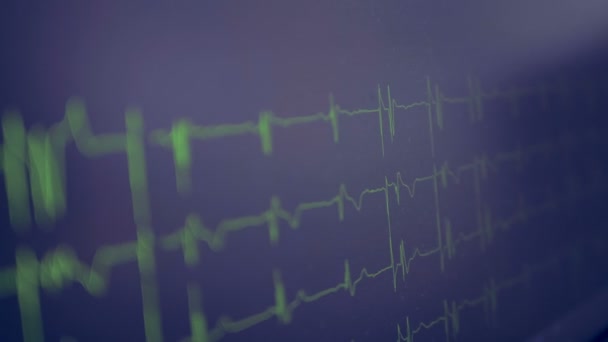 EKG grafik bir ekran monitör üzerinde. — Stok video