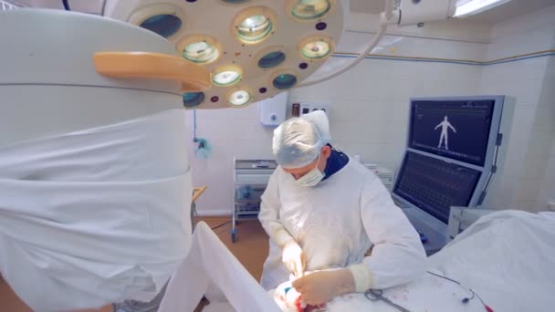 外科医は、手術用縫合糸を適用します。. — ストック動画