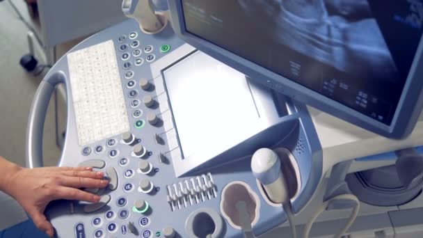Vista dall'alto di un'apparecchiatura a ultrasuoni funzionante . — Video Stock