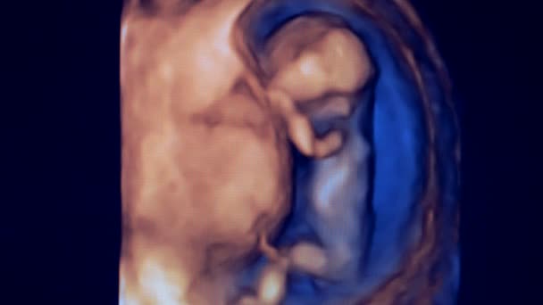 母親の子宮に小さな人間の胎児の画像 — ストック動画