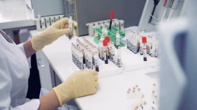 Bir hemşire kan tüpleri sıralar, yakın çekim.