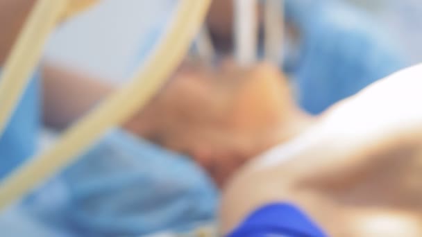 Le patient reçoit une anesthésie pendant une intervention chirurgicale. 4K . — Video