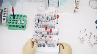 Bir kadın Hemşire kan örnekleri tüplerde bir tabloda özel bir raf üzerine koyar. Üstten Görünüm.