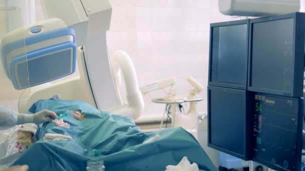 Un cirujano mueve a un paciente, usando equipo médico, realizando una cirugía en un hospital. 4K . — Vídeo de stock