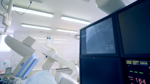 L'attrezzatura medica speciale lavora, mentre i monitor mostrano l'immagine di cuori. 4K . — Video Stock