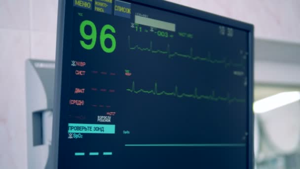 O monitor especial mostra a condição dos corações durante uma cirurgia. 4K . — Vídeo de Stock