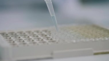 Bir kişi hastane laboratuvarında numunelerle çalışıyor..