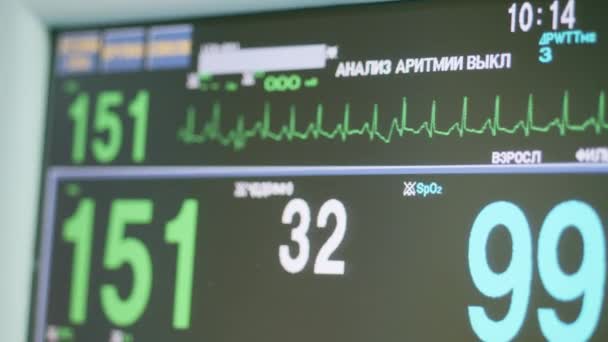 Herzfrequenz auf einem Display in einer Klinik. — Stockvideo