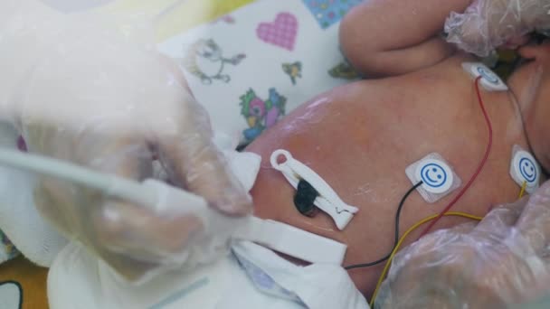 Läkaren använder ultraljudsutrustning när han arbetar med barn i inkubatorn. — Stockvideo
