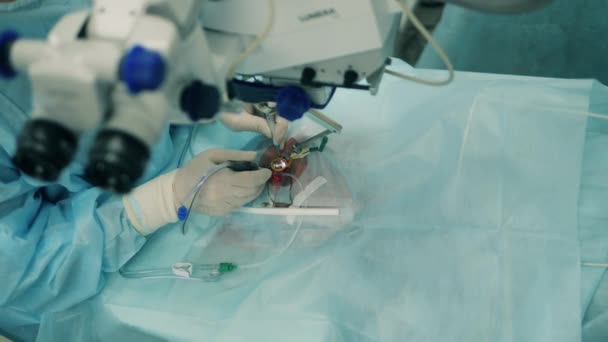 Человек делает глазную операцию в клинике . — стоковое видео