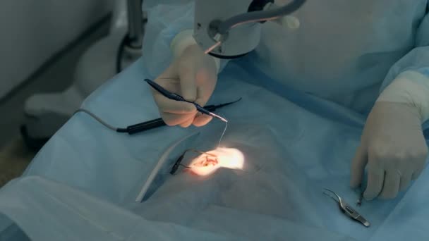 Ο επαγγελματίας χειρουργός εργάζεται στην οφθαλμολογική κλινική. — Αρχείο Βίντεο