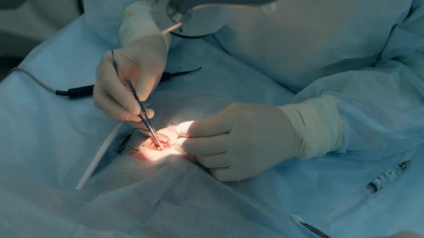 A sebészek emberi szemet operálnak. — Stock videók