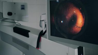 Tıbbi monitörden göz ameliyatı..