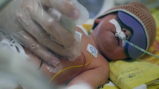 Newborn baby is undergoing ultrasound under medical control — 비디오