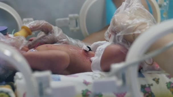 I medici stanno distraendo un bambino mentre fanno gli ultrasuoni — Video Stock