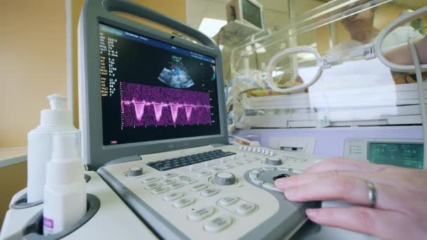 Ultraschallmechanismus während des Eingriffs an einem Baby — Stockvideo