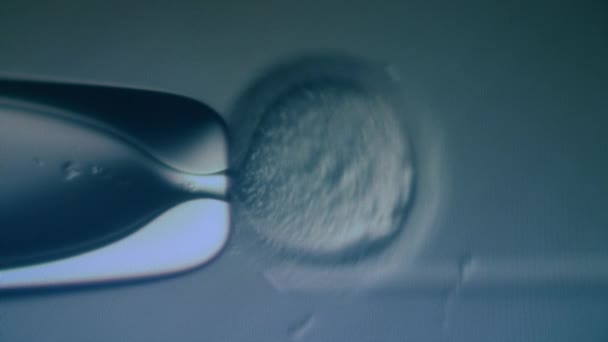 In vitro fertilization under a microscope. — Stockvideo