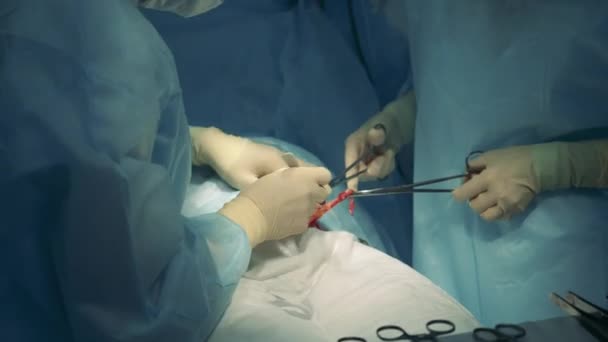 Врачи, выполняющие операцию на пациенте . — стоковое видео