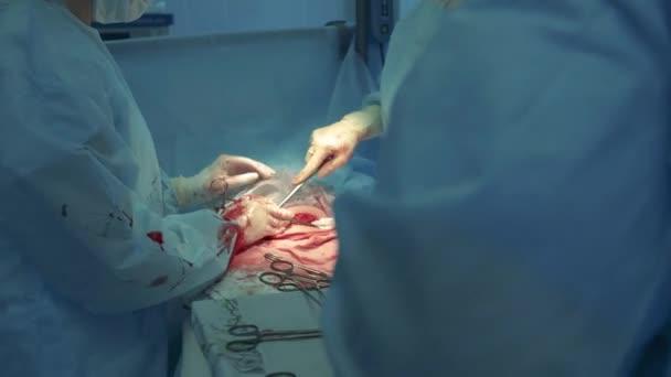 Une équipe de chirurgiens effectue une opération dans une clinique . — Video