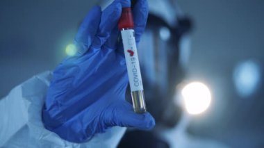 Bir laboratuvar çalışanının elindeki kovid 19 test tüpünü kapat. Epidemiyoloji uzmanı Coronavirus COVID-19 numuneleri üzerinde çalışıyor. Küresel Salgın Konsepti.