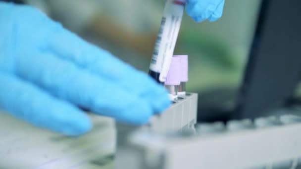Primer plano de las muestras bioquímicas insertándose en una paleta. Proceso de detección del coronavirus Covid-19 . — Vídeos de Stock