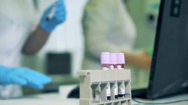 Laboratuvar çalışanı kan dolu tüpleri bir araya getiriyor. Coronavirus, covid-19 laboratuvar testi..