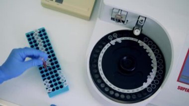 Test numuneleri yüklenen santrifüj makinesi. Coronavirus, covid-19 laboratuvar testi..