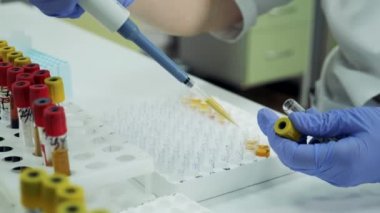 Coronavirus, covid-19 laboratuvar testi. Laboratuvar çalışanı cam tüpleri plazmayla dolduruyor.