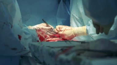 Cerrahlar hastaların midesini dikiyor.