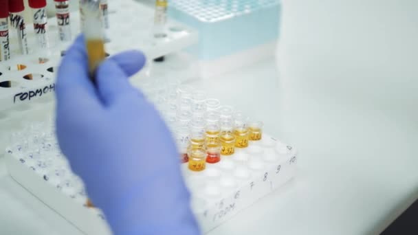 Eine Person arbeitet mit Proben im Labor. Covid-19-Test, Covid-19-Impfkonzept. — Stockvideo