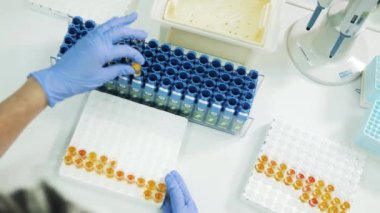 Bir kişi numunelerle tüpleri tepsiye yerleştiriyor. Covid-19 testi, covid-19 aşı konsepti.