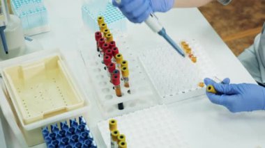 Klinik çalışanı tüpler üzerinde çalışırken pipet kullanır. Covid-19 testi, covid-19 aşı konsepti.