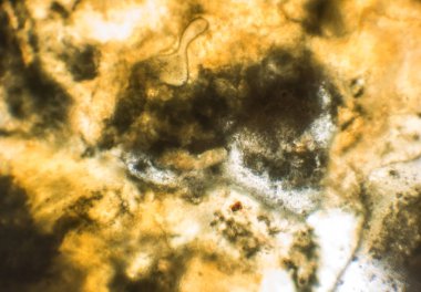 Küflü soğan ampul, mikroskop görünüm