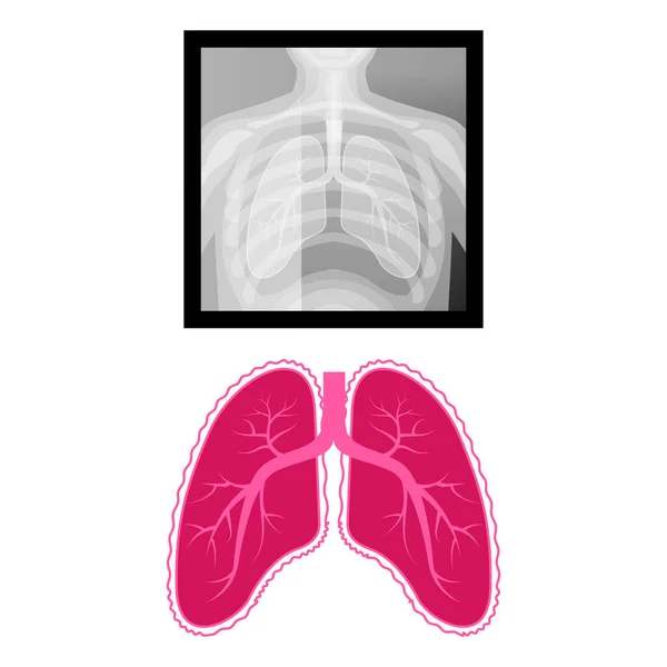 Illustrazione Vettoriale Radiografia Dei Polmoni Esempio Della Forma Dei Polmoni — Vettoriale Stock