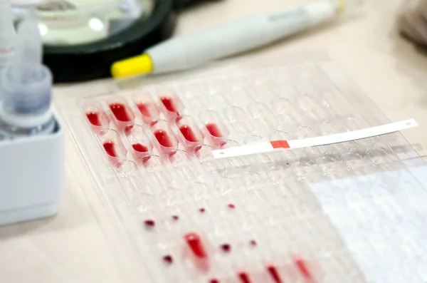 Litmus strip on pallets with the blood to determine the Rh factor.