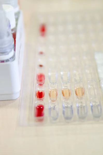 Reticulação do sangue para determinar o fator Rh e os grupos sanguíneos . — Fotografia de Stock