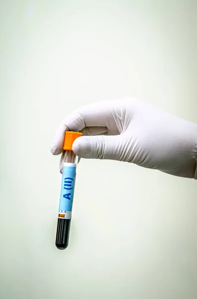 Médico em luvas médicas de látex segurando um tubo de teste com um segundo grupo de sangue . — Fotografia de Stock