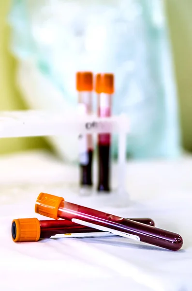 Dois tubos com sangue para análise. No fundo é um tripé com tubos de ensaio . — Fotografia de Stock