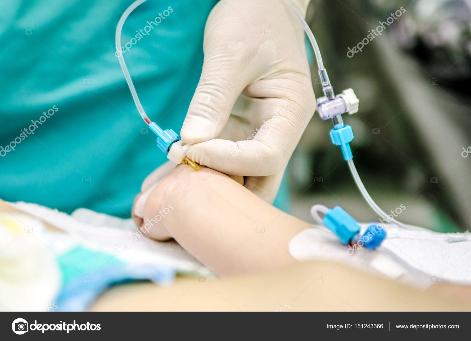 Setting by the doctor of a peripheral catheter to monitor invasive