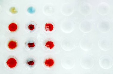 Kan grubu ve donör ve hastanın bireysel uyumluluğu.