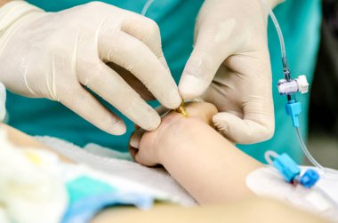 Periferik bir kateter doktoru invaziv kan basıncını izlemek için ayarlama.