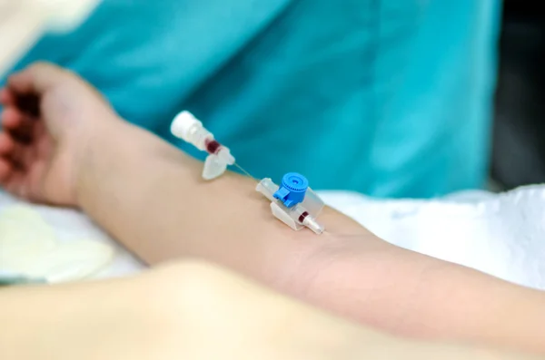 Periphere Venenkatheter für intravenöse Infusion. — Stockfoto