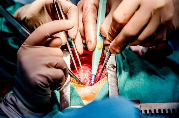 The process of heart surgery.