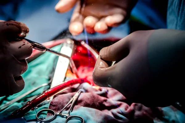 El proceso de cirugía cardíaca. El foco está en la pinza médica y la succión en el brazo del cirujano. Un corte es visible en el fondo . —  Fotos de Stock