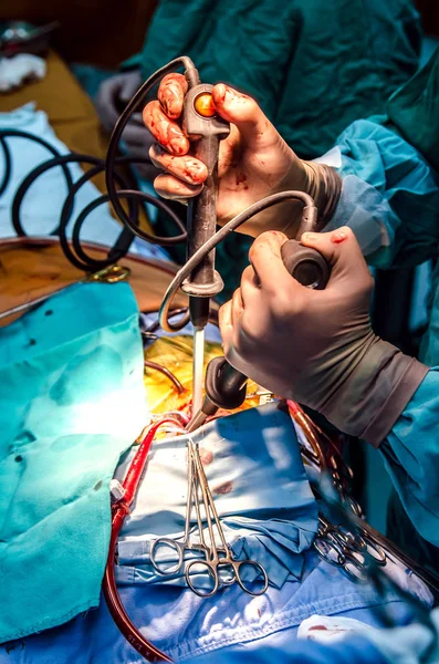Cirurgião Elimina Fibrilação Durante Cirurgia Cardíaca — Fotografia de Stock