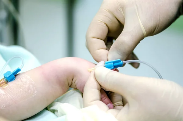 Anestesiologist Installerar Perifer Kateter Handleden Till Patienten Innan Operation — Stockfoto