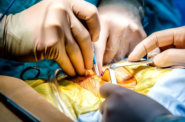 The surgeon's assistant spreads the wound with special medical instruments. The surgeon performs the incision with the help of a medical electron-knife.