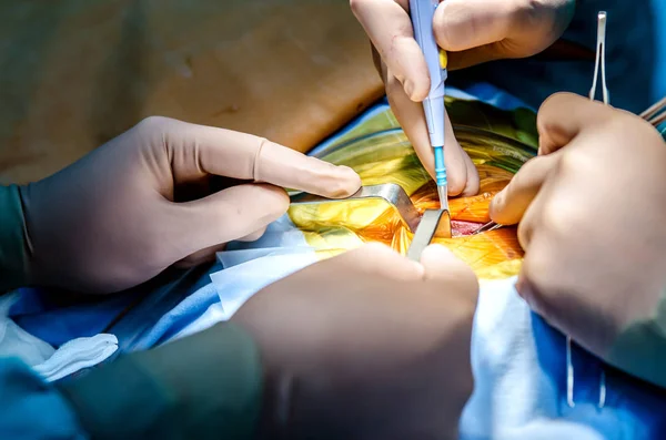 Процес Виконання Кардіохірургічного Розрізу Бічного Доступу Серця Електронно Ніжкою — стокове фото
